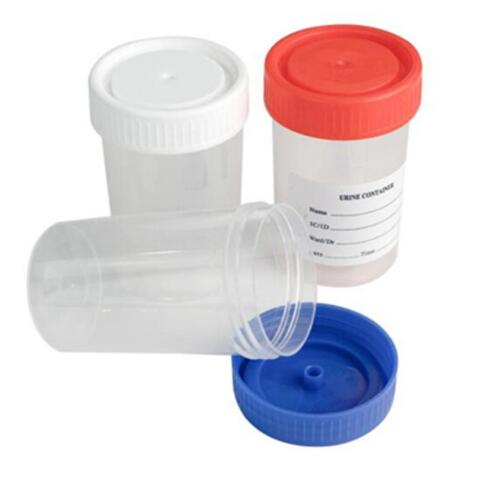 Sterile specimen urine collection cup container