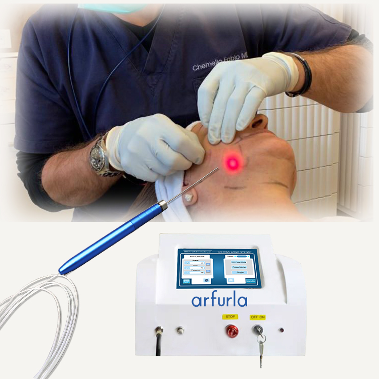 Arfurla 980nm+1470nm diode laser lipolysis machine laser equipment for weight loss