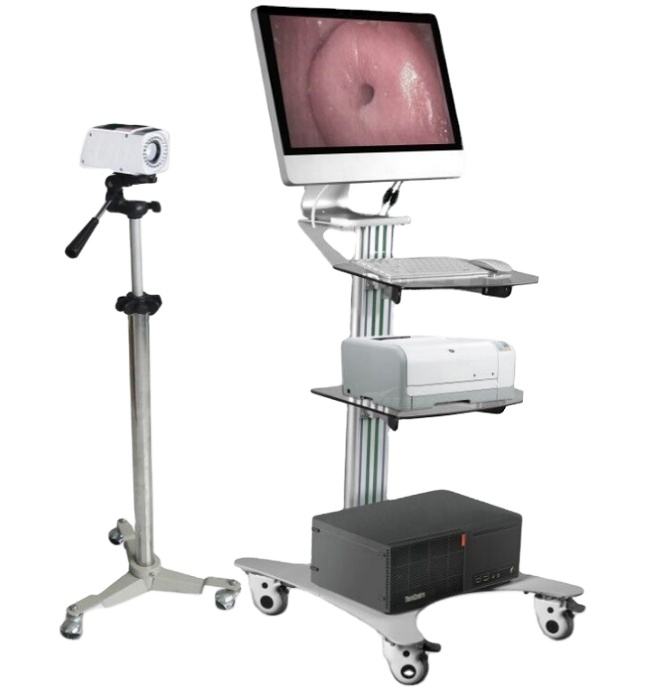 Portable Trolley Endoscope internal medicine Gynecology Vagina Examination Full HD Digital Video Colposcope