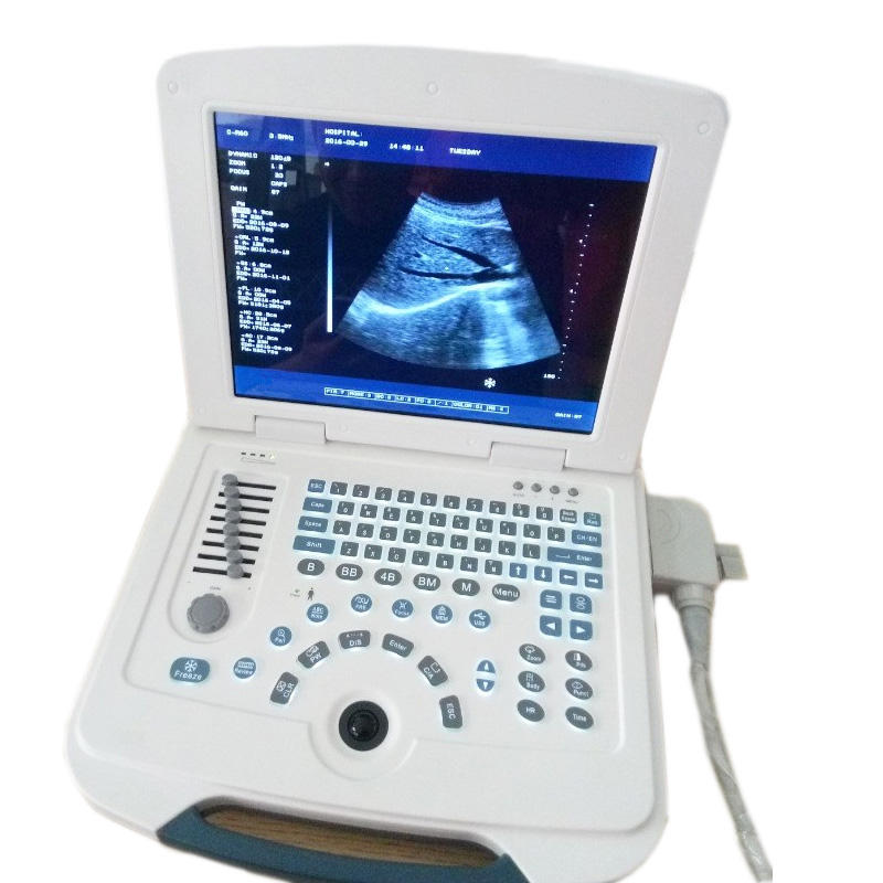 Medical Black and White Ultrasound Scanner Portable Ultrasound Machines laptop ultrasound scanner For Sale