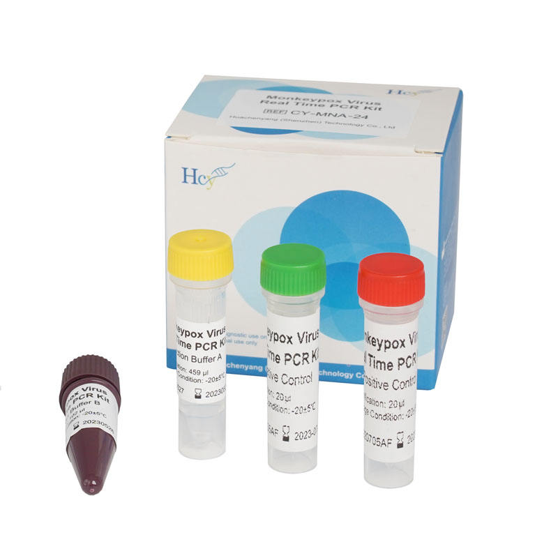 HCY Molecular Biology Reagents Monkeypox PCR Test Kit Monkeypox Rapid Test Kits
