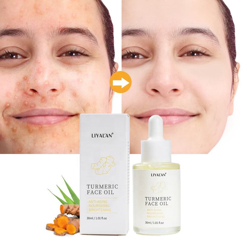 Wholesale Organic Natural Tumeric Facial Serum Oil Anti Aging Anti Acne Whitening Turmeric Face Oil