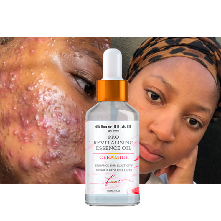 Pigmentation Correctors & Remove Acne & Firming American Women Skin Care Facial Rose Oil For Face